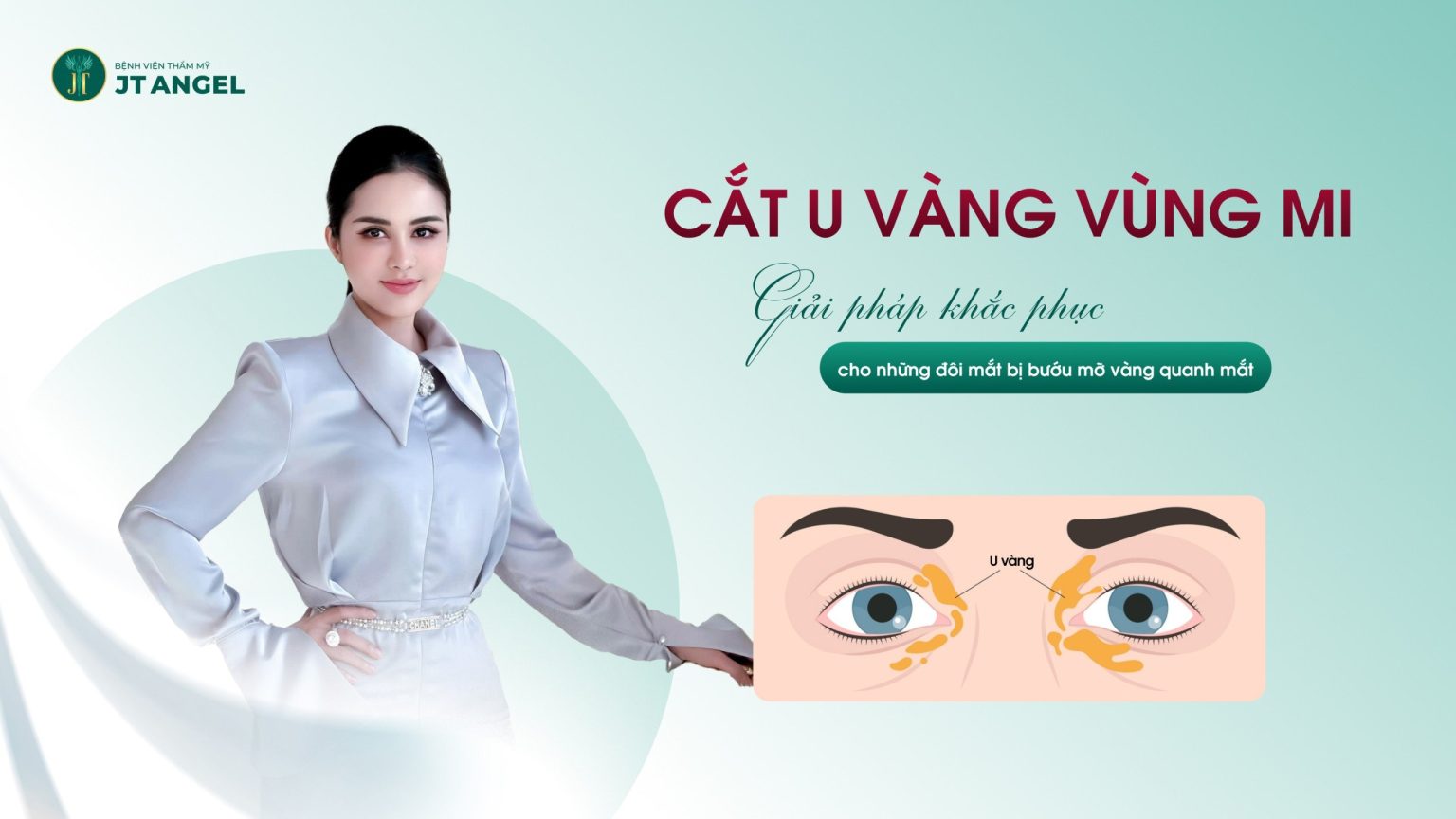 CẮT U VÀNG VÙNG MI: GIẢI PHÁP KHẮC PHỤC CHO NHỮNG ĐÔI MẮT BỊ BƯỚU MỠ VÀNG QUANH MẮT